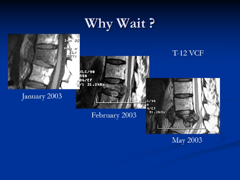 Why Wait ? T-12 VCF January 2003 February 2003 May 2003